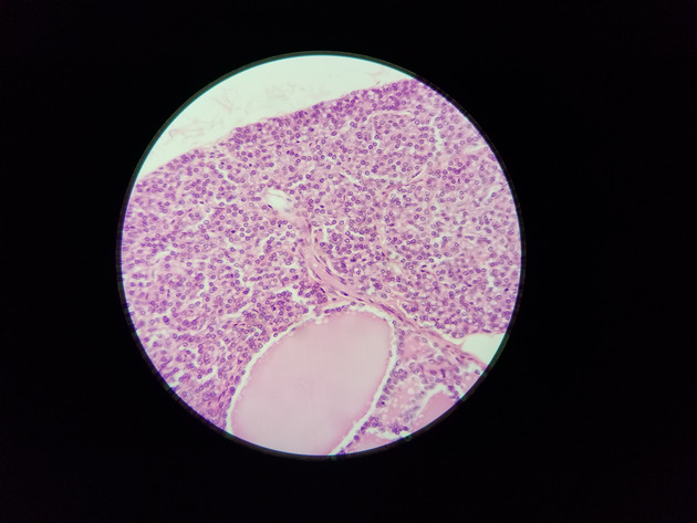 Parathyroid Thyroid Slides - Parathyroid_Thyroid 012 400X